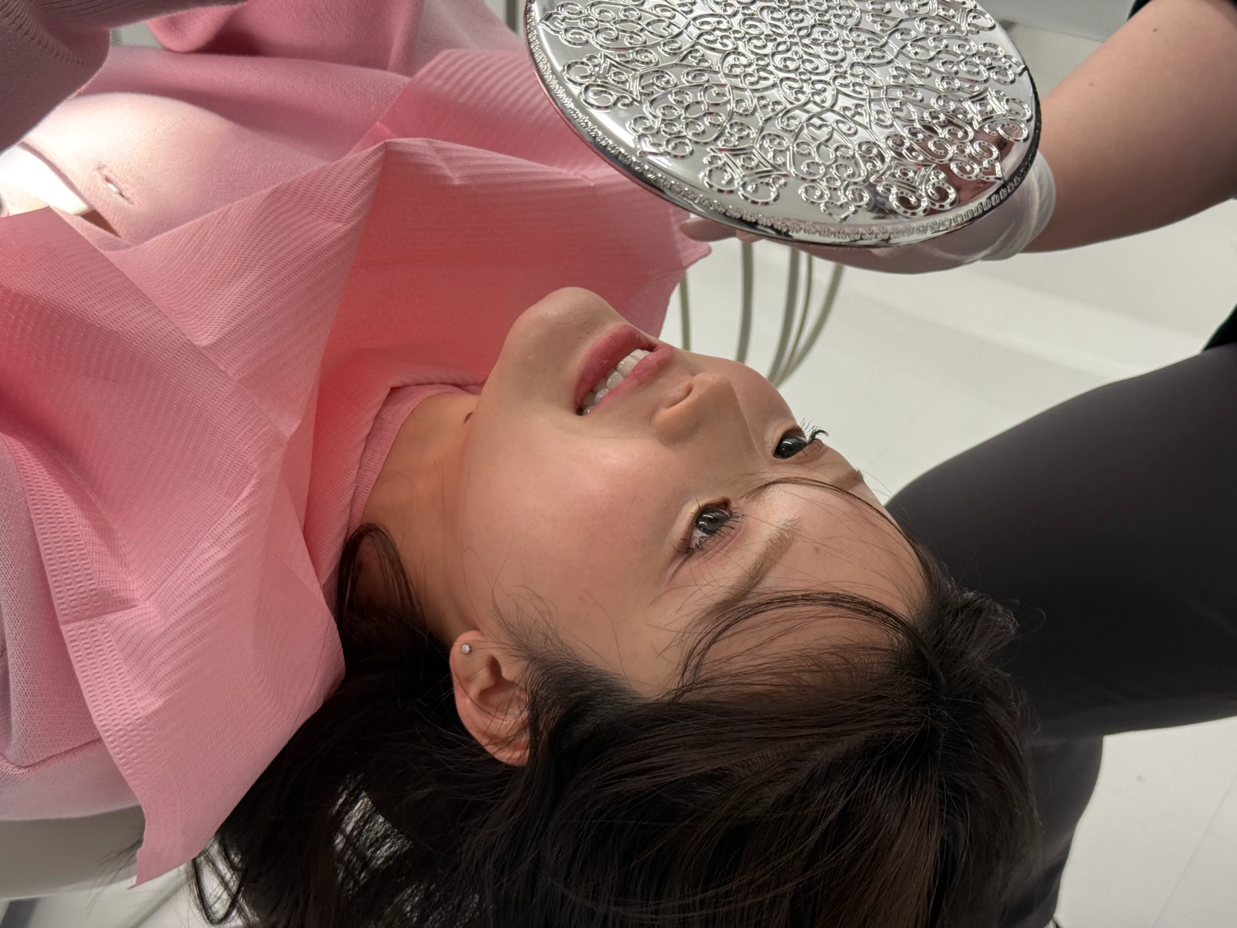 ミニッシュ装着